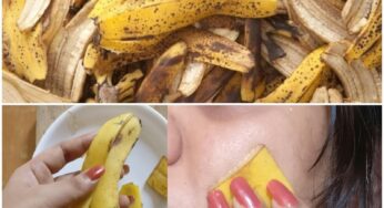Banana Peel Magic Say Goodbye to Pimples with a DIY Banana Face Mask