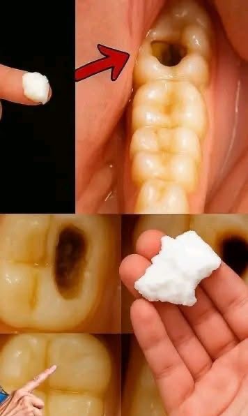 The Hidden Secret to a Dazzling Smile: Can Baking Soda Really Save Your Teeth