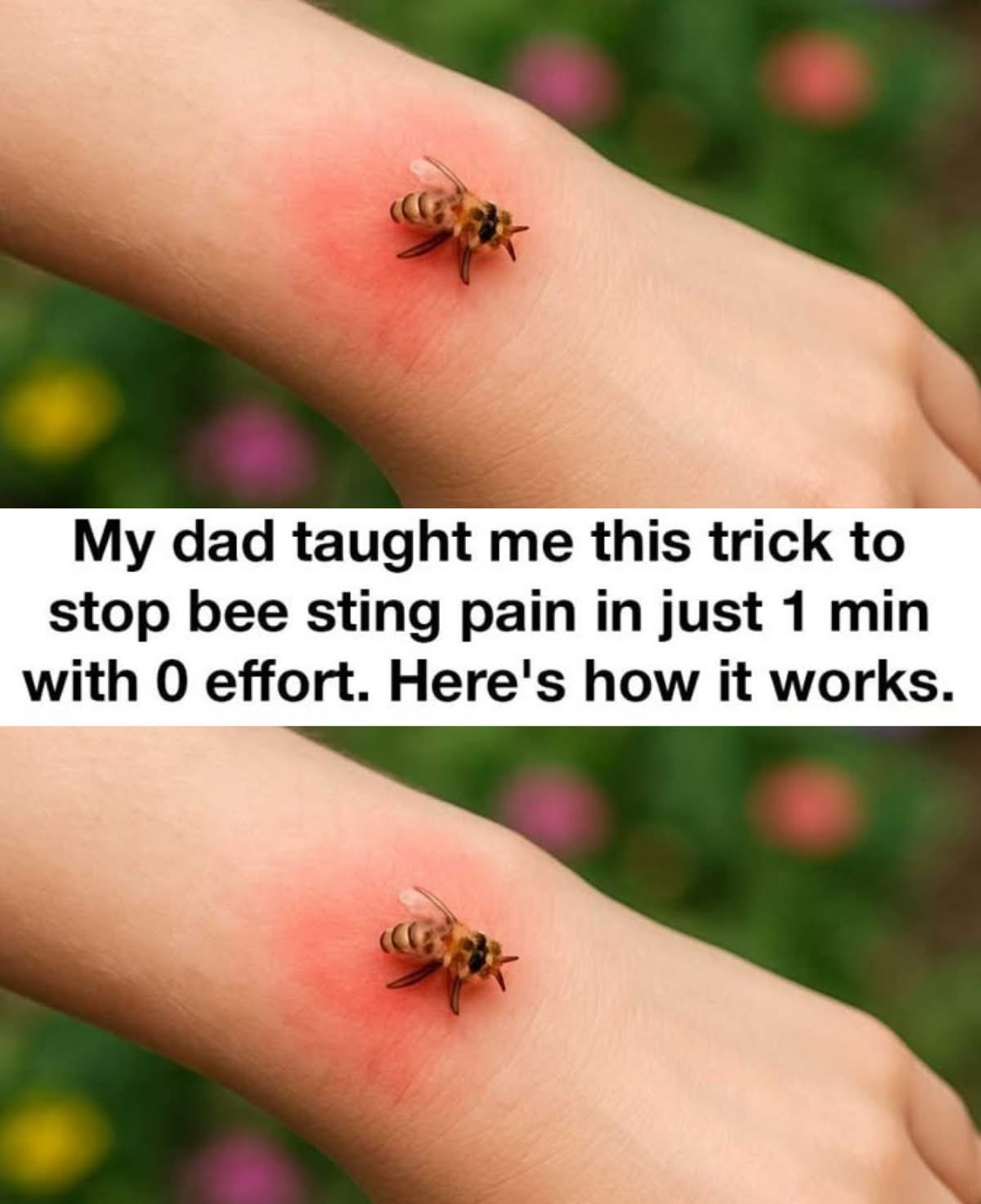 I Didn’t Know This — But My Dad’s 1-Minute Bee Sting Trick Works Like Magic