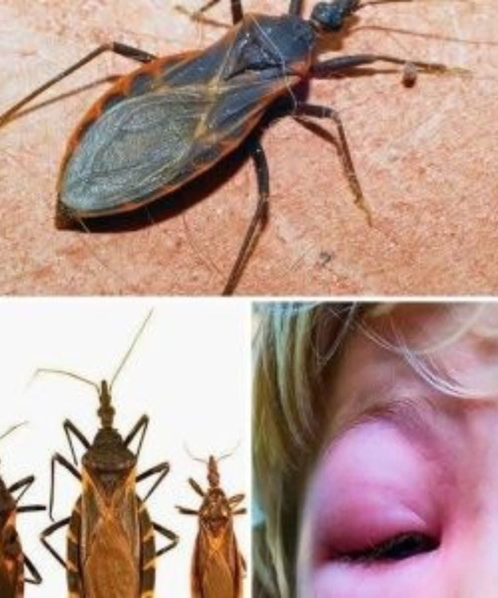 Kissing Bug (Triatomine Bug) and Chagas Disease: A Comprehensive Guide