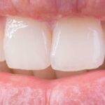 Close-up of healthy white teeth and lips