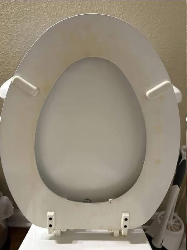 That Gross Yellow Ring? Here’s How I Actually Got Rid of Toilet Stains