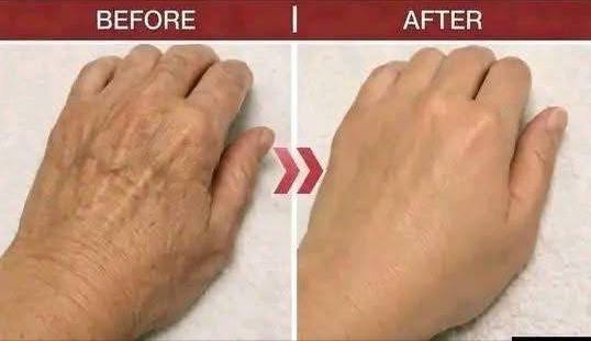 How Toothpaste Can Improve the Appearance of Age Spots and Wrinkles Naturally