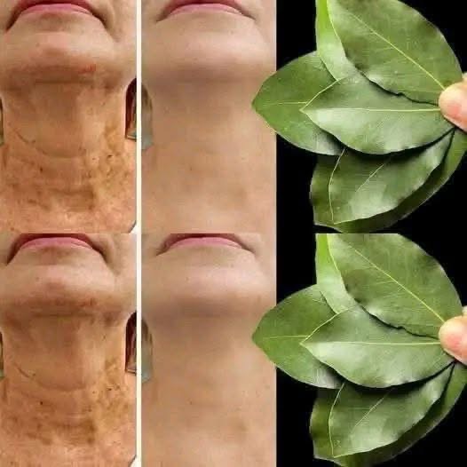 Bay Leaf for Wrinkles: Can This Ancient Herb Support Smoother, Younger-Looking Skin?